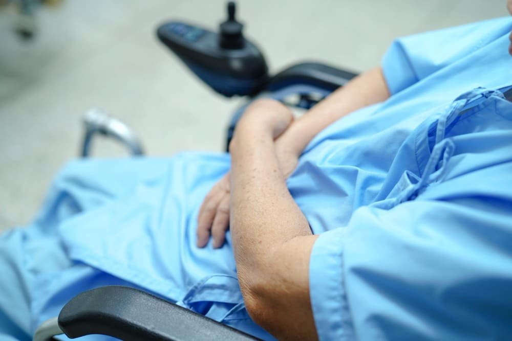 Circuncisión láser