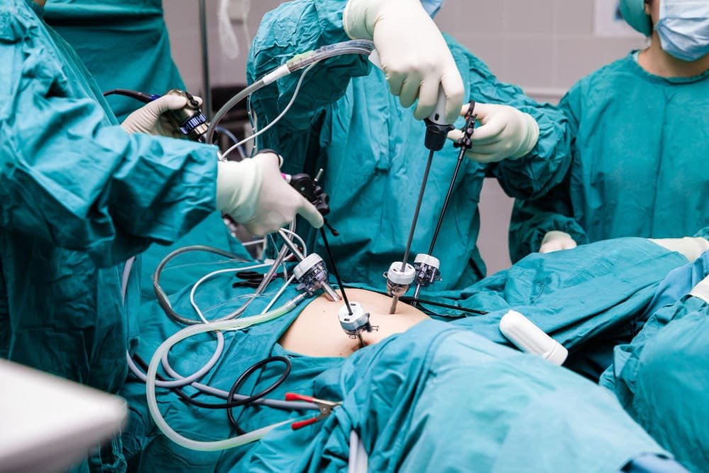 Prostatectomía radical laparoscópica